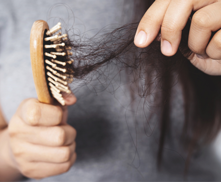 Problema Di Perdita Dei Capelli